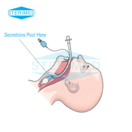 Endotracheal Tube Secretions Pool