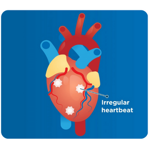 cardiac arrest